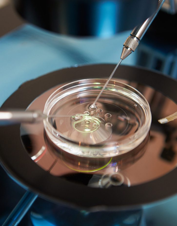 Laboratory Fertilization Of Eggs In IVF Treatment Laboratory Fertilization Of Eggs In IVF Treatment